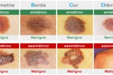 Imagem de Dermatologia Clnica